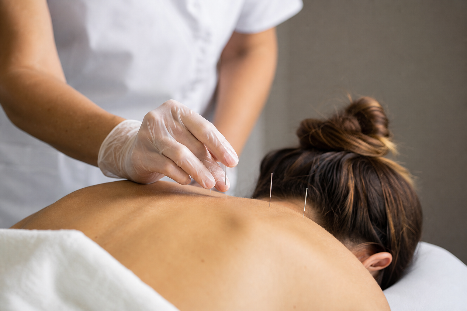 Acupuncture Needle Insertion on Upper Shoulder